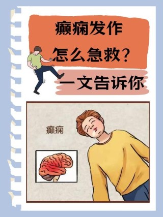 癫痫无解
