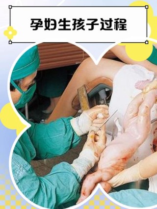 生个孩子多大个事