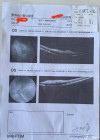 品读｜32岁眼科医生突发心脏骤停去世，妻子迅速决定捐出遗体角膜，又救两人的眼睛