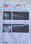 品读｜32岁眼科医生突发心脏骤停去世，妻子迅速决定捐出遗体角膜，又救两人的眼睛