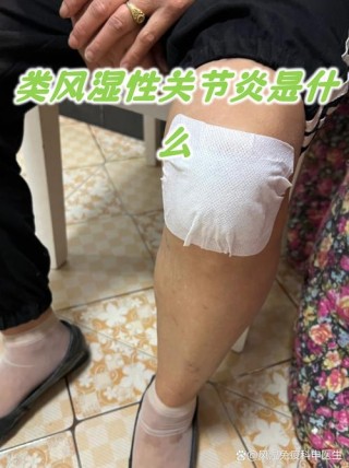 风湿性关节炎三年用药小测评！我的关节炎终于缓解了！