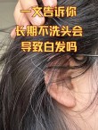头上找白发 （打四字国名）