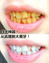 美白牙齿小妙招，让你轻松告别大黄牙