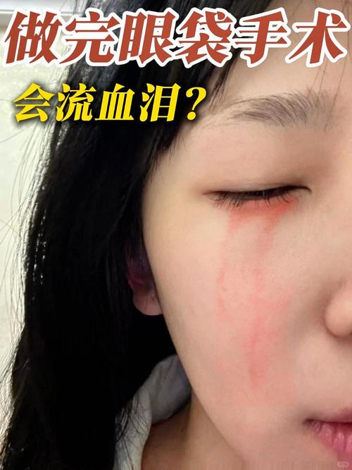 血泪疤痕  第1张