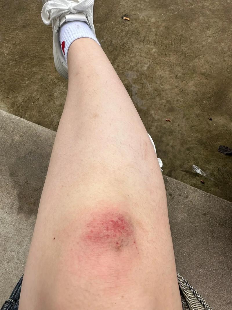 受伤了，爬起来  第1张