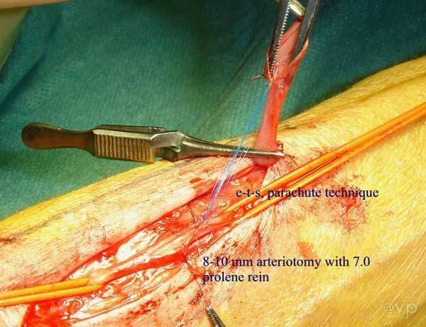 完美吻合  第1张