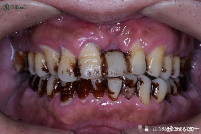 罗斯福咬紧他的牙根  第1张