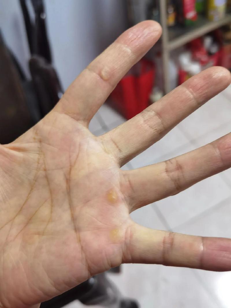 文人的老茧 第1张 文人的老茧 第1张