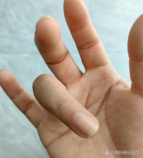 无名指,是我留给你的位置 第1张 无名指,是我留给你的位置 第1张