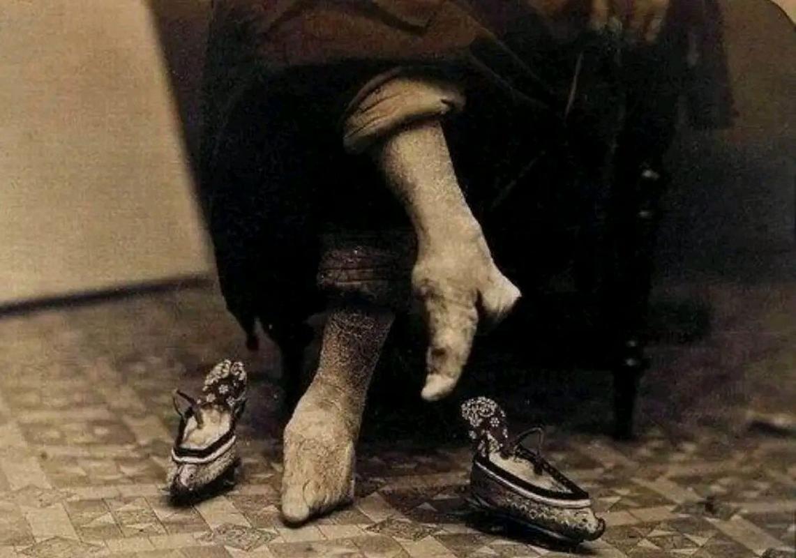 三寸金莲  第1张