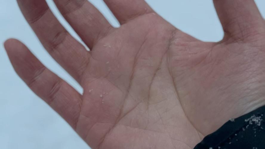 掌心化雪  第1张